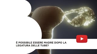 È possibile essere madre dopo la legatura delle tube [upl. by Nnalyrehc]