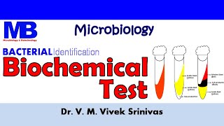 BIOCHEMICAL TEST  Bacterial Identification Technique  Microbiology  Vivek Srinivas Bacteriology [upl. by Sirdna493]