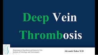 Deep Vein Thrombosis [upl. by Cad]