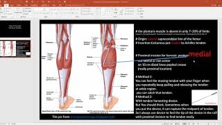 Harvest plantaris tendon [upl. by Adlee225]