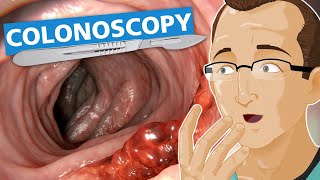 Colonoscopy [upl. by Fachini748]