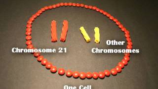 Nondisjunction Trisomy 21  An Animated Tutorial [upl. by Gupta]