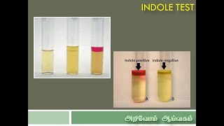 Indole Test in Tamil [upl. by Wilbert]