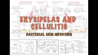 Bacterial Skin Infection  Cellulitis and Erysipelas Clinical Presentation Pathology Treatment [upl. by Maxma]