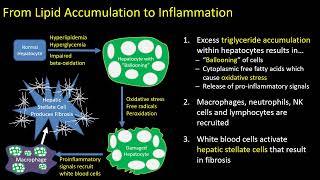 Hepatic Steatosis Part 1 Pathophysiology [upl. by Felicity]