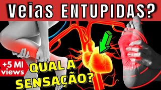 VEIA ENTUPIDA QUAL A SENSAÇÃO Como combater a falta de circulação nas pernas pés e coração [upl. by Nitsrek387]