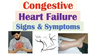 Congestive Heart Failure Signs amp Symptoms amp Why They Occur [upl. by Wolpert]