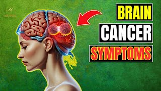 Brain Cancer Symptoms You Cant Afford to Ignore [upl. by Groveman211]