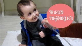 BEBEKLERDE BURUN TIKANIKLIÄI NASIL GEÃ‡ER  EN ETKÄ°LÄ° ÃœRÃœN BABY VAC  1 ÃœRÃœN 1000 Ã–VGÃœ 2 [upl. by Norag281]