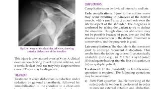 shoulder dislocations Elbow dislocations and Hip dislocations [upl. by Ivar]