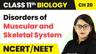 Disorders of Muscular amp Skeletal System  Locomotion amp Movement  Class 11 Biology Ch 20 NCERTNEET [upl. by Nicky]