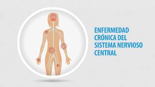 ¿Qué es la fibromialgia [upl. by Jadda]