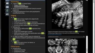 Ultrasound identification of IUD is unreliable sometimes When in doubt do X ray to verify [upl. by Arhoz]