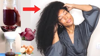 HOW TO USE ONION DECOCTION FOR MASSIVE HAIR GROWTH  ONIONS FOR EXTREME HAIR GROWTH [upl. by Dorkas]