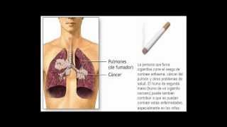 Documental sobre el daño que produce el consumo del cigarrillo [upl. by Haikezeh]