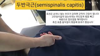 두반극근  semispinalis capitis  촉진및 도수운동 ㅡ뒷목과 등이 뻐근하다면 이 근육일수도 있습니다 목틍증 등통증 [upl. by Afinom]