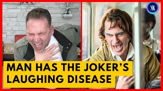 This Man Has The Same Laughing Disease As The Joker [upl. by Fabe74]