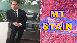 HOW TO DO MT STAIN [upl. by Neve]