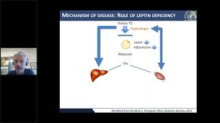 Understanding Lipodystrophy [upl. by Pacheco730]