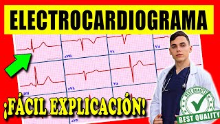 ELECTROCARDIOGRAMA Interpretación [upl. by Ayihsa]