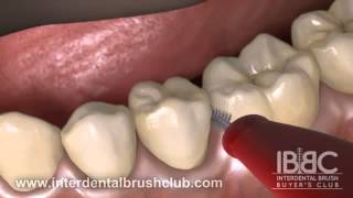 HOW TO USE AN INTERDENTAL BRUSH [upl. by Andrey]