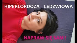 HIPERLORDOZA LĘDŹWIOWA  napraw to jednym ćwiczeniem [upl. by Aener546]