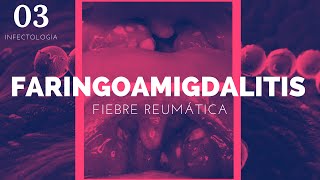 Faringoamigdalitis y Fiebre reumática  ENARM [upl. by Idner266]