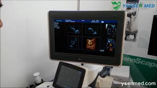 Sonoscape S40 4D Doppler Color Ultrasound S40 Demo  YSENMED  YUESEN MED [upl. by Avad]