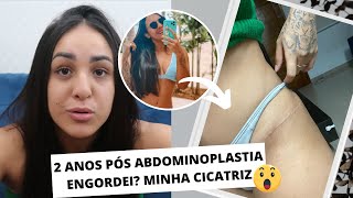 2 ANOS PÃ“S ABDOMINOPLASTIA COM LIPO  MOSTREI A CICATRIZ EU ENGORDEI ME ARREPENDI DE TER FEITO [upl. by Coney105]