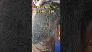 nits hair nitsremoval eeru haircare peenu ytshorts nits removal treatment hair problem [upl. by Kaden]