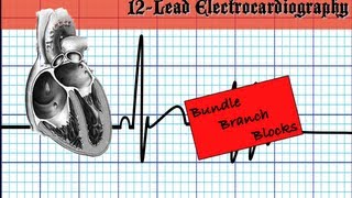 Bundle Branch Blocks  Part 1 [upl. by Dailey]