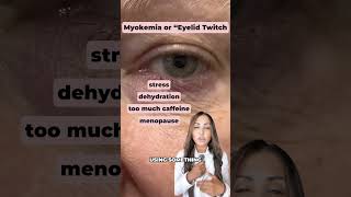 Does your eyelid twitch short shorts healthtips lifehacks healthyliving symptoms eyes [upl. by Susann]