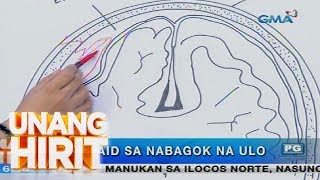 Unang Hirit Ano ang dapat gawin kapag nauntog o nabagok ang ulo [upl. by Leiso]