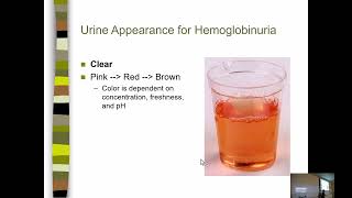 UA Lecture 6 Blood Bilirubin and Urobilinogen [upl. by Erline]