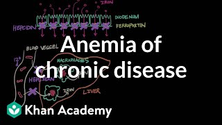 Anemia of chronic disease  Hematologic System Diseases  NCLEXRN  Khan Academy [upl. by Audra]