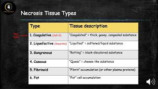 Necrosis 1 Coagulative [upl. by Breanne]