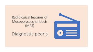 Radiological features of Mucopolysaccharidosis MPS [upl. by Anirac]