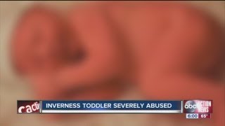 Citrus County toddler severely abused and neglected mother arrested [upl. by Elleinnad702]