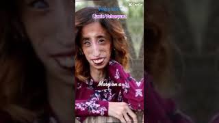 Lizzie Velasquez [upl. by Sergius]