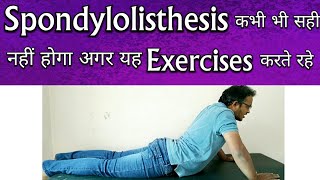 Spondylolisthesis Exercises  Exercises To AVOID For Spondylolisthesis TREATMENT [upl. by Acined]