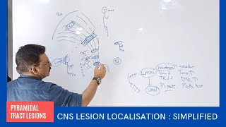 CNS Lesion Localisation at your Finger Tips by Dr Gireesh Kumar KP  Simplified Version [upl. by Elnukeda]