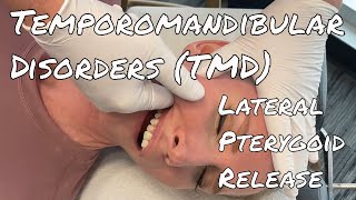 TMDTMJ Pain  MSR Lateral Pterygoid Release [upl. by Guarino]