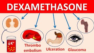 Dexamethasone tablets decadron  Mechanism side effects amp precautions [upl. by Curr543]