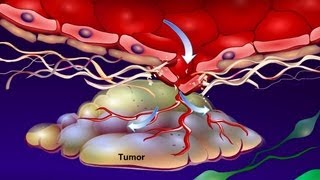 Introduction to Cancer Biology Part 4 Angiogenesis [upl. by Ruhnke]