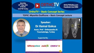 Myositis Ossificans A Basic Concept Lecture  Kemal Gokus [upl. by Olwena]