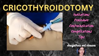 205cricothyroidotomy cricothyrotomy procedure airway emergency stridor [upl. by Eylatan]