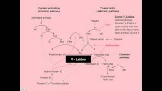 Coagulation Disorders  CRASH Medical Review Series [upl. by Onairda]