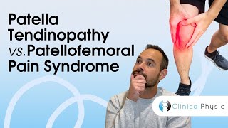 Patella Tendinopathy vs Patellofemoral Pain Syndrome  Expert Physio Guide [upl. by Lorianne]