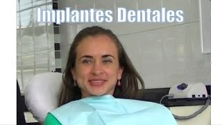 Testimonio de jovencita con Implantes Dentales frontales  Odontologia Estetica en Bogota [upl. by Atsejam]