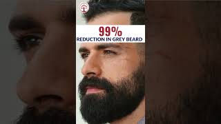 Ivory Natural  Grey Beard Serum  Reverse Premature Greying with Highly Potent Serum serum shorts [upl. by Drue]